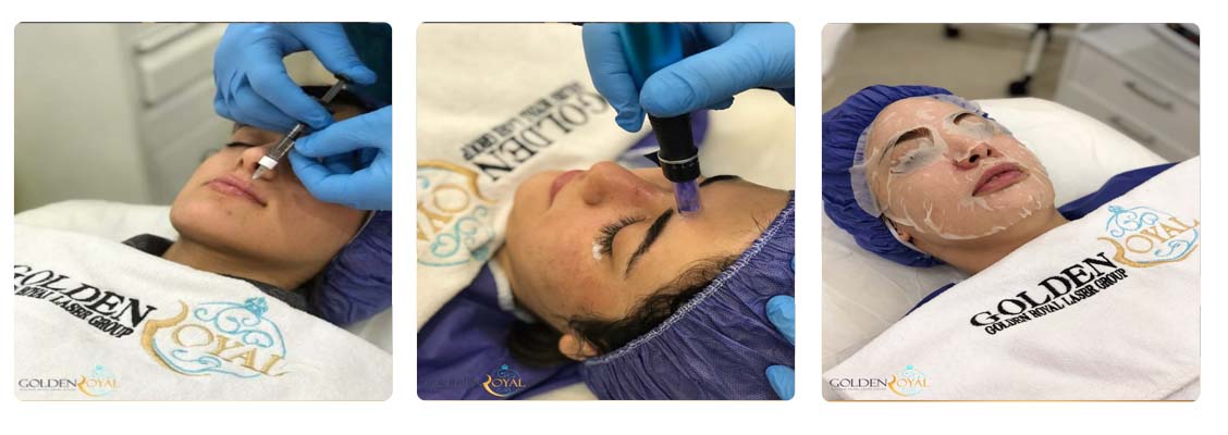کلینیک زیبایی گلدن رویال