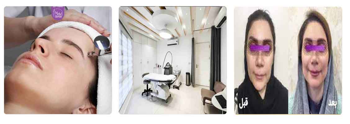 کلینیک ایرانیان مرکز پاکسازی صورت