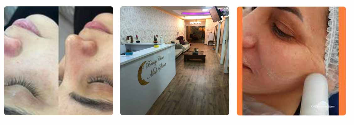 مرکز تخصصی مه سیما