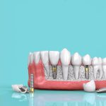 کلینیک دندانپزشکی رز سفید