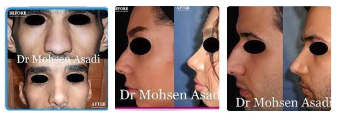 دکتر محسن اسدی