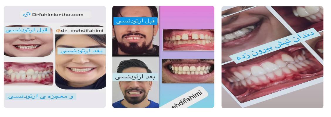 نمونه کار بهترین متخصص ارتودنسی دکتر فهیمی