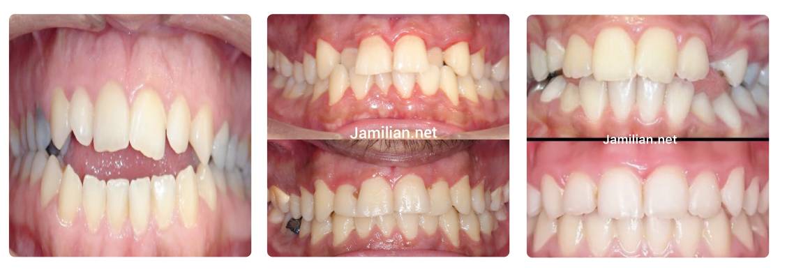 دکتر جمیلیان متخصص ارتودنسی