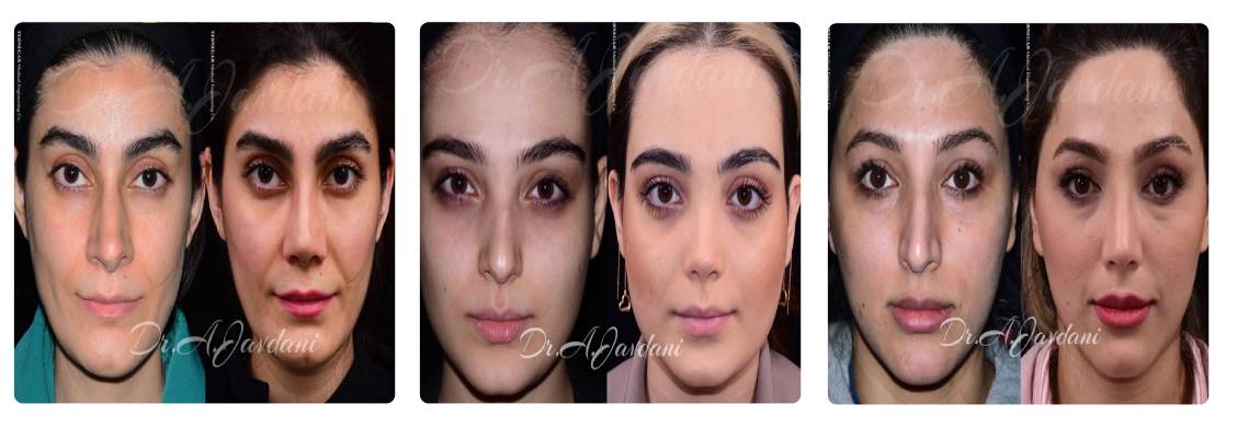 دکتر علی جاودانی از بهترین جراحان بینی