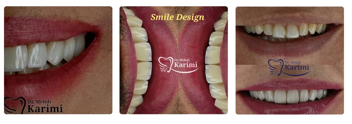 دکتر مهدی کریمی