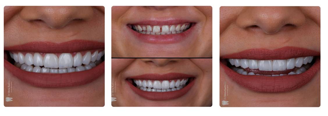 دکتر مونا کشکولی