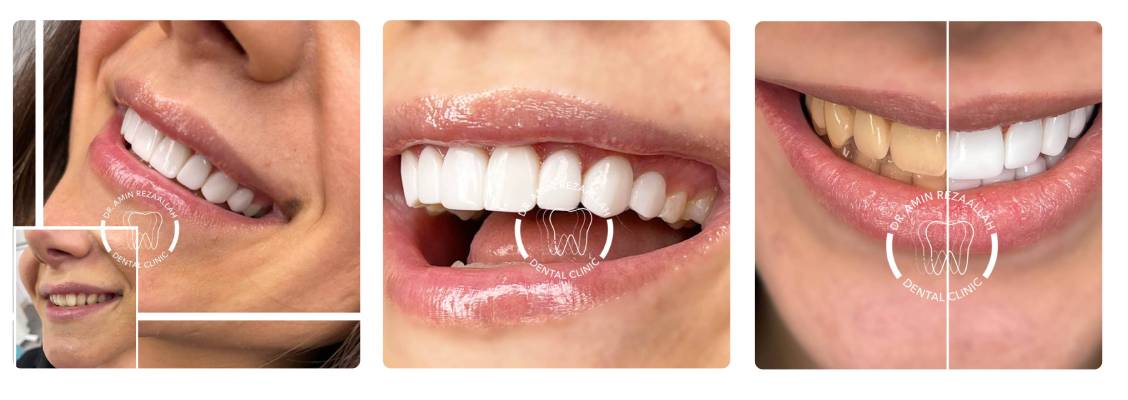 دکتر رضاله جراح دندان