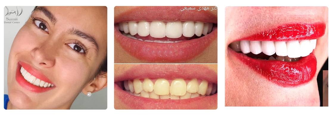 جراح دندان دکتر مهدی سمیعی