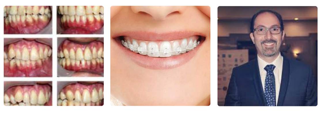 متخصص ارتودنسی دکتر زرنگار