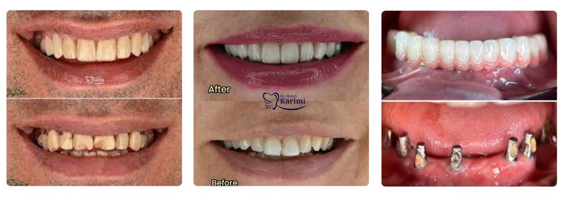 دکتر مهدی کریمی