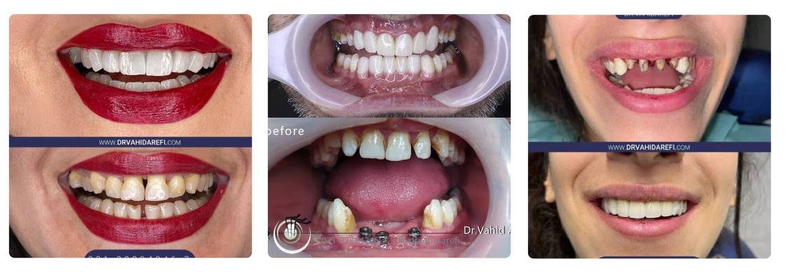 دکتر وحید عارفی