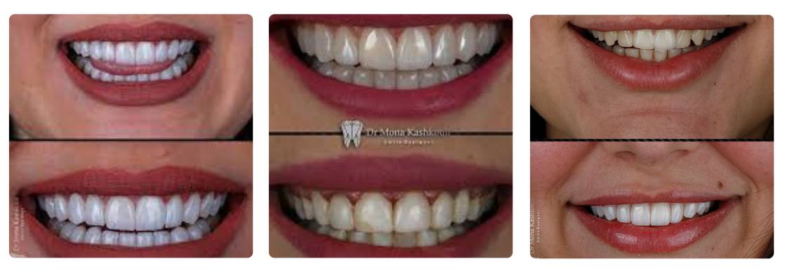 دکتر مونا کشکولی