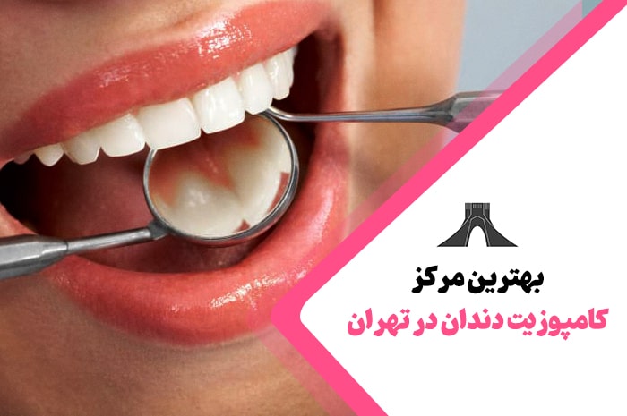 بهترین مرکز کامپوزیت دندان در تهران