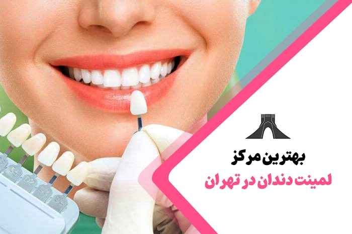 بهترین لمینت دندان در تهران