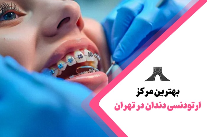 بهترین متخصص ارتودنسی در تهران