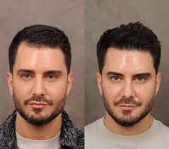 مرکز زیبایی دکتر آذر رحیمی