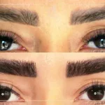 کلینیک تهران کاشت