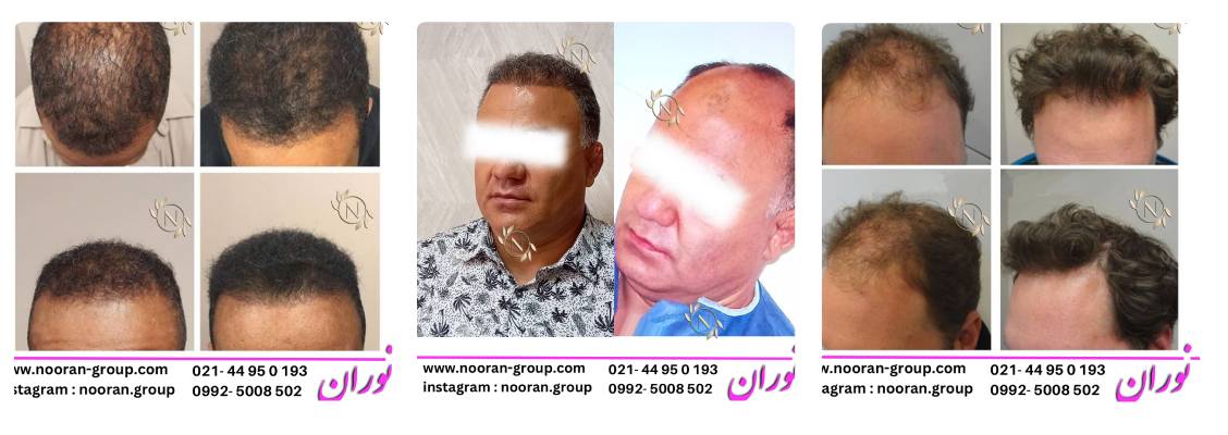 کلینیک زیبایی نوران