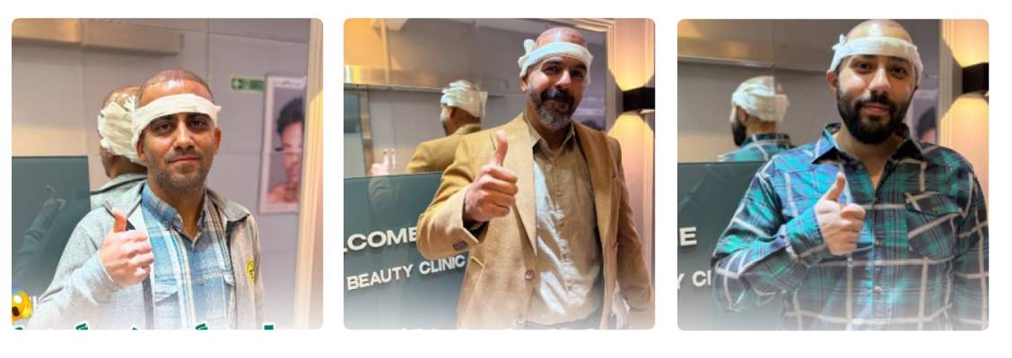 کلینیک کاشت مو آدنیس