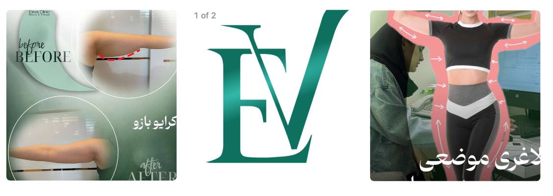 کلینیک زیبایی اوا