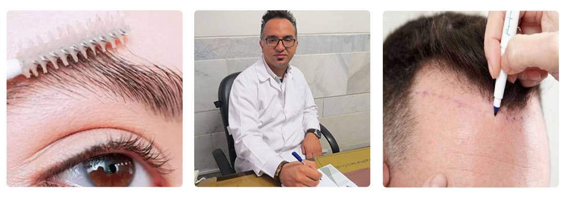 کلینیک کاشت مو حامد منادی