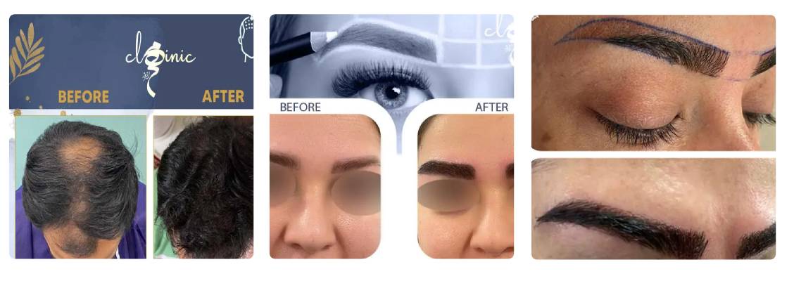 کلینیک زیبایی مهرافروز