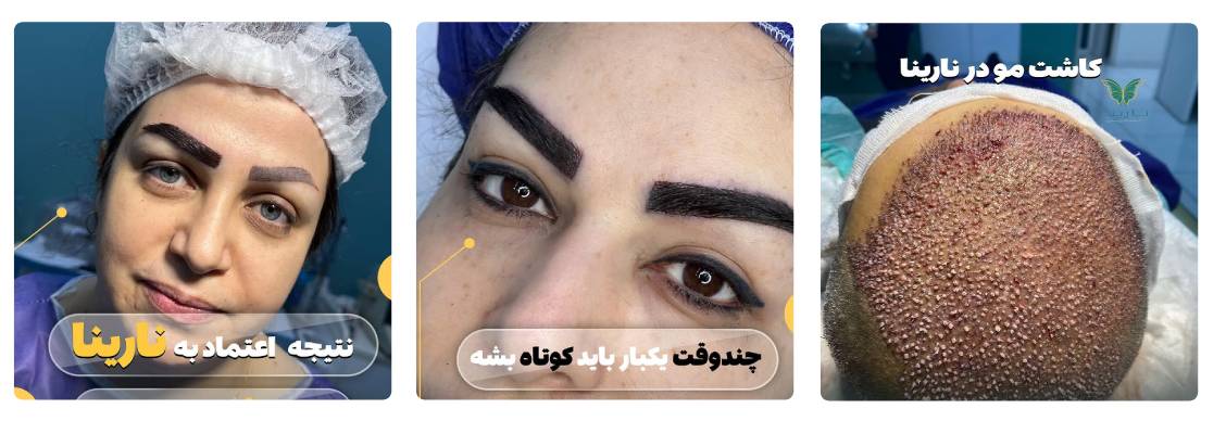 کلینیک زیبایی نارینا