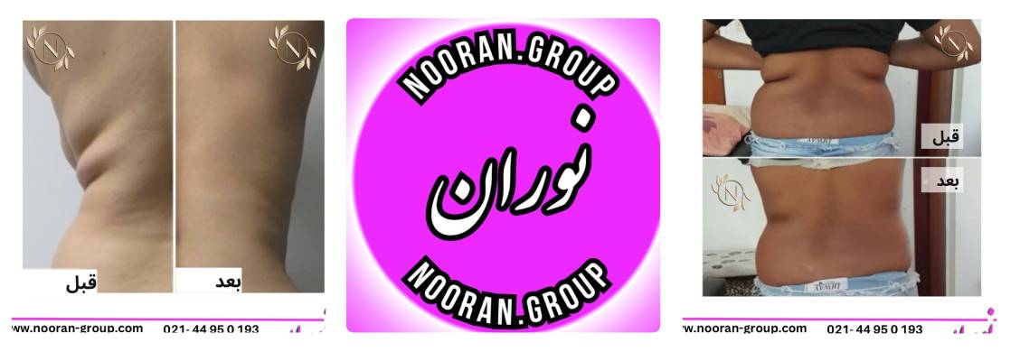 کلینیک زیبایی نوران