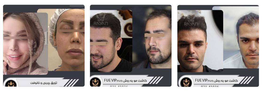 کلینیک زیبایی رایان