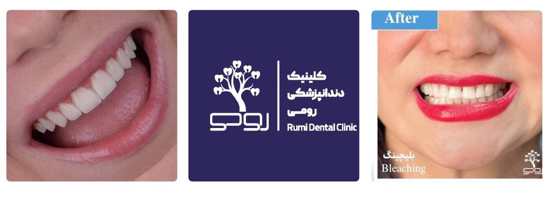 کلینیک دندانپزشکی رومی