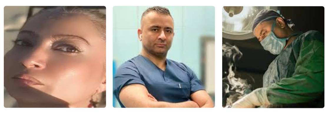 دکتر کامبیز ایزدپناه لیفت صورت