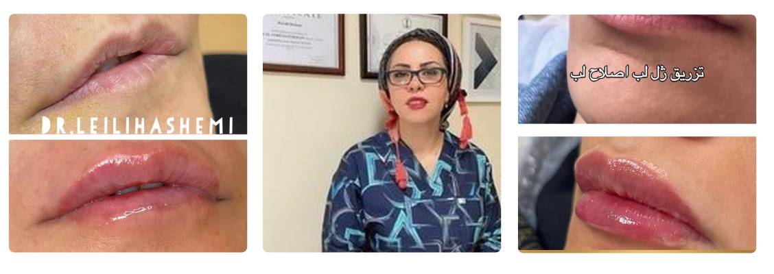 دکتر لیلی هاشمی