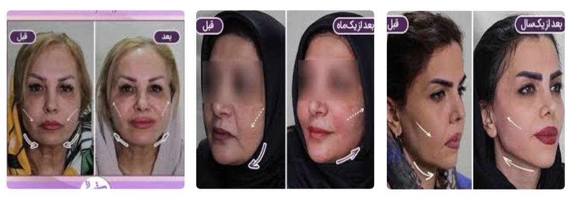 دکتر مرتضی جلالی فخر