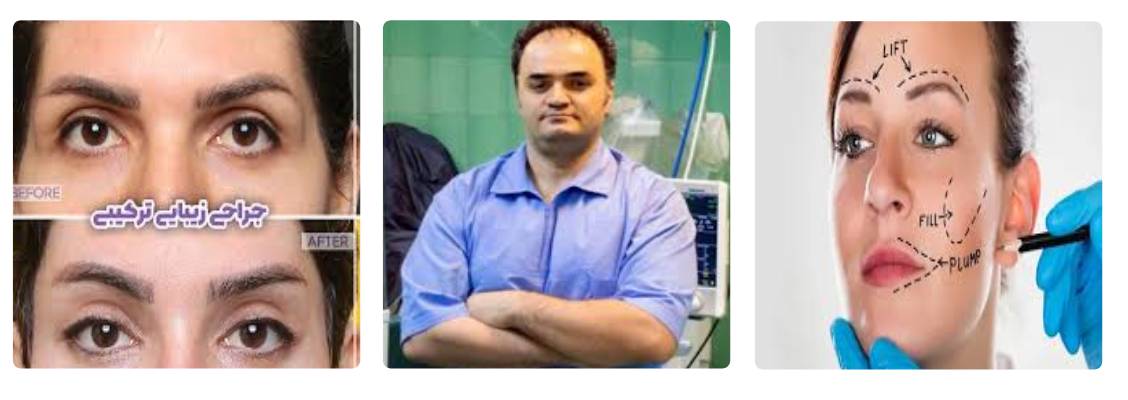 دکتر مهدی احمدی