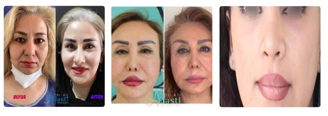 دکتر علی الستی