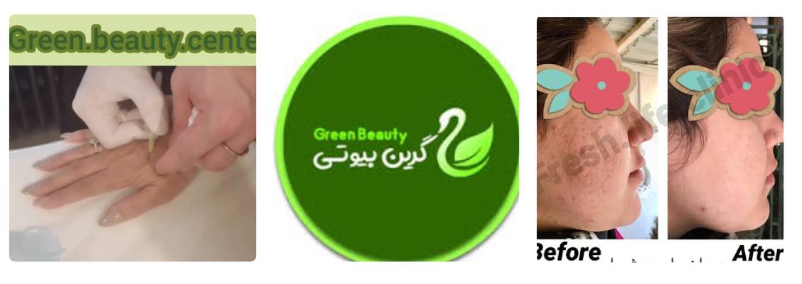 کلینیک گرین بیوتی