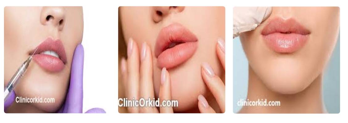 کلینیک ارکید