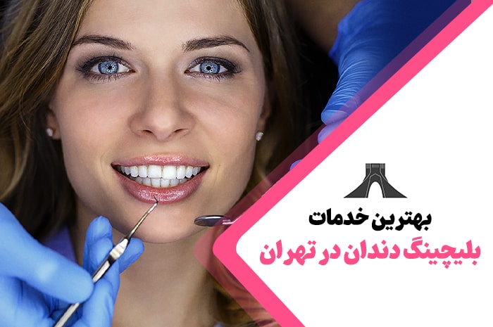 بهترین خدمات بلیچینگ دندان در تهران