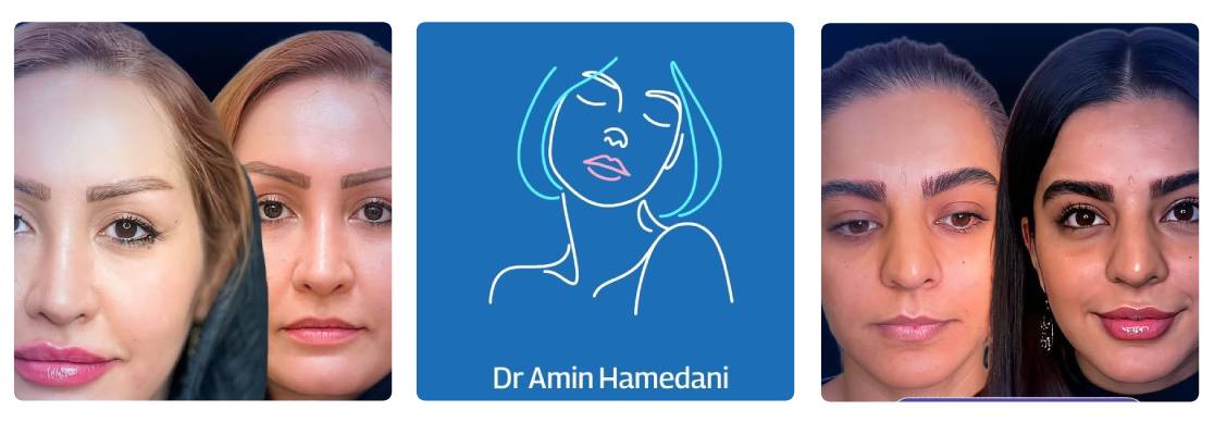 کلینیک آدری مرکز بوتاکس تهران