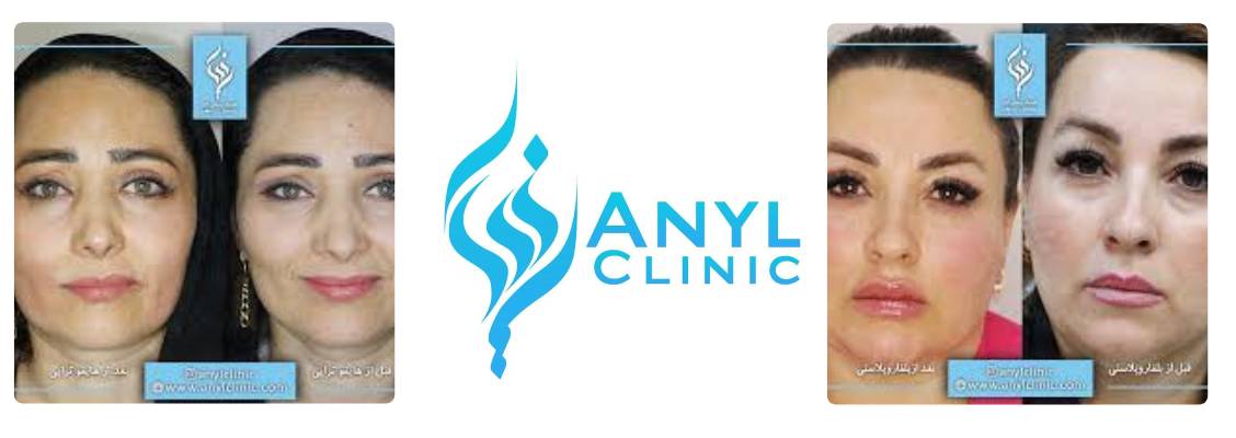 کلینیک زیبایی آنیل
