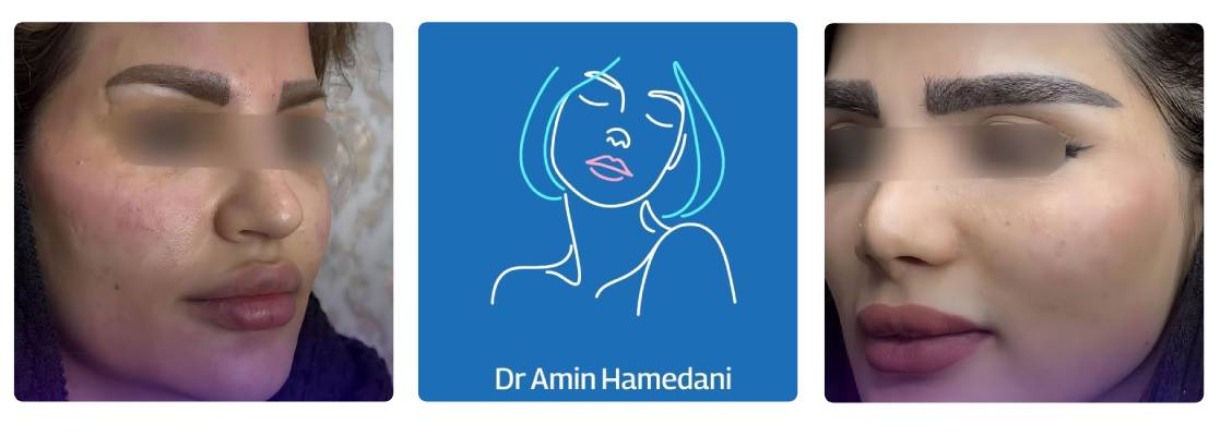 کلینیک آدری ئ تزریق چربی تهران