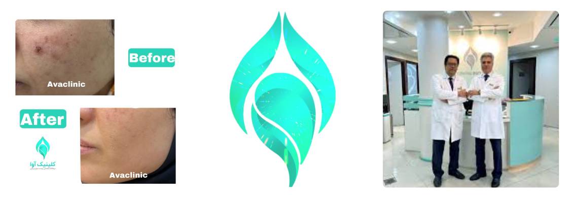 کلینیک زیبایی آوا مرکز تخصصی فشیال