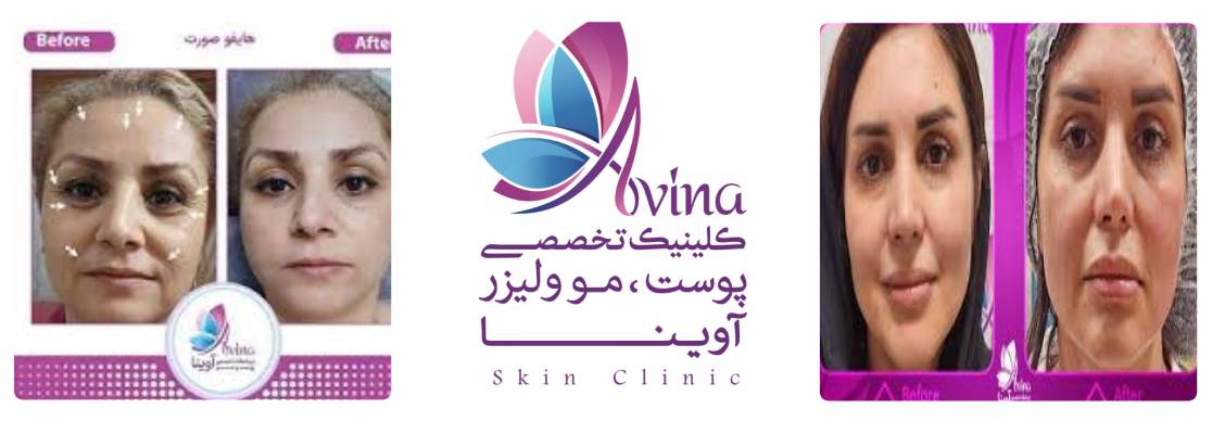 کلینیک زیبایی آوینا