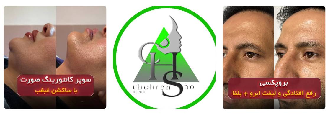 کلینیک چهره شو