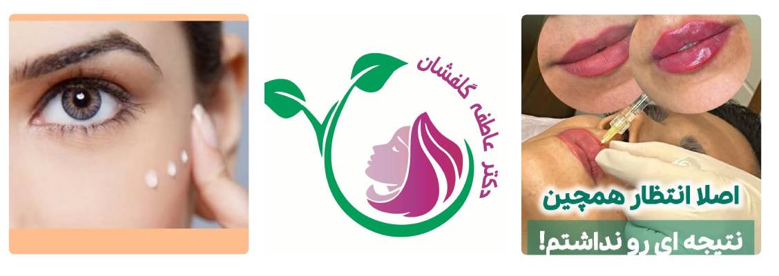 دکتر عاطفه گلفشان بهترین متخصص تزریق فیلر تهران