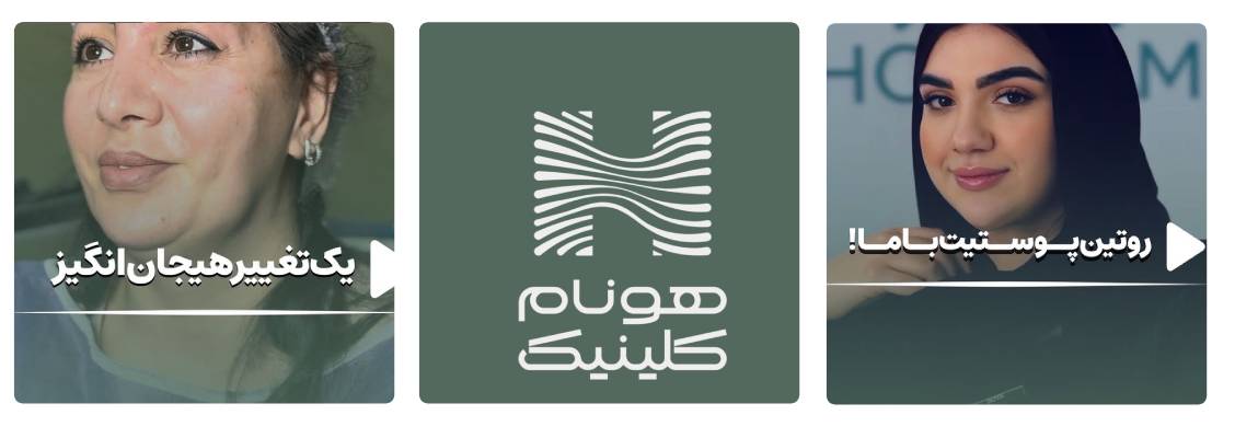 کلینیک زیبایی هونام مرکز فشیال تهران