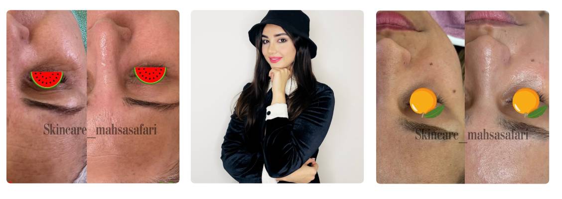 کلینیک مهسا مرکز تخصصی فشیال تهران