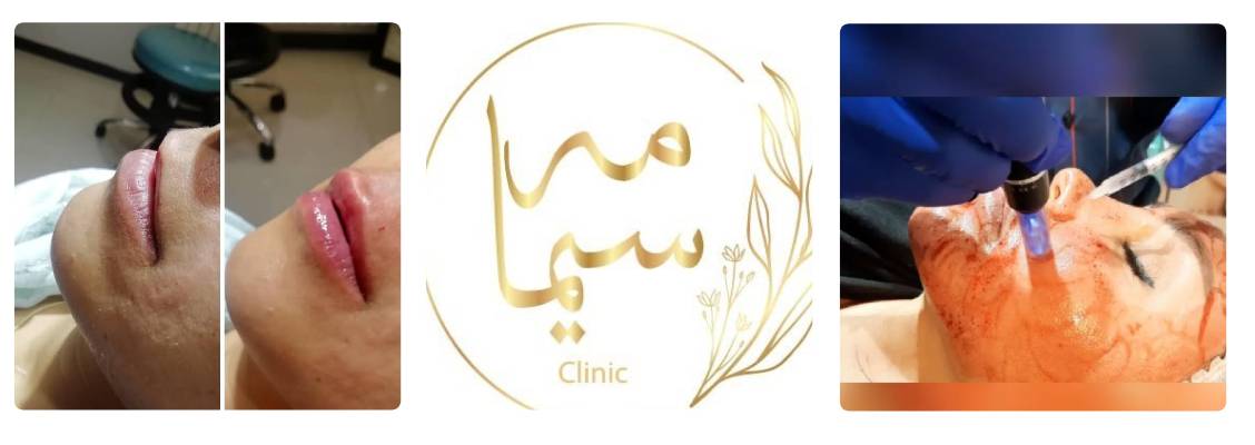 کلینیک مه سیما