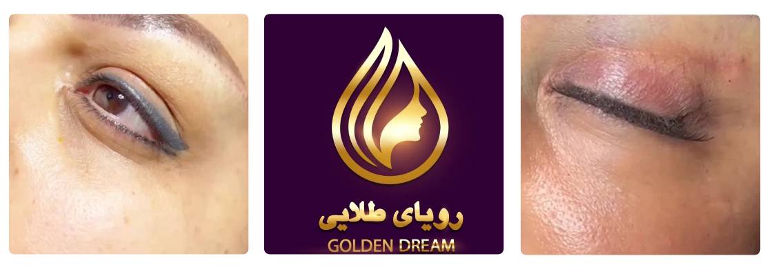 فشیال تهران در کلینیک رویای طلایی