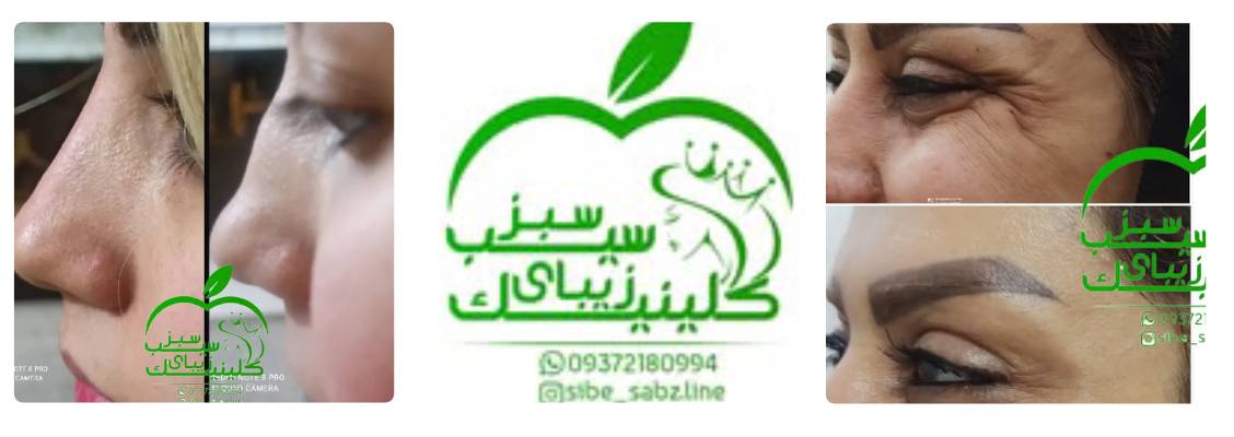 کلینیک زیبایی سیب سبز